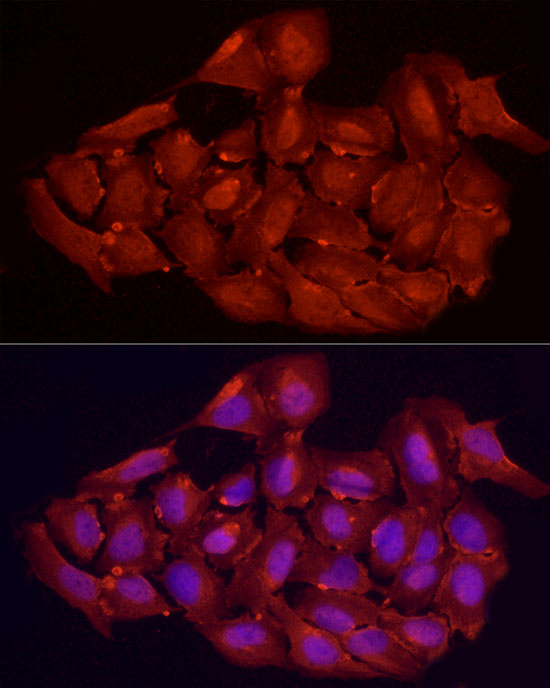 Immunofluorescence analysis of U2OS cells using VDR Polyclonal Antibody at dilution of 1:100 (40x lens). Blue: DAPI for nuclear staining.