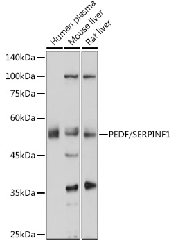 Western blot analysis of extracts of various cell lines using PEDF/PEDF/SERPINF1 Polyclonal Antibody at 1:1000 dilution.