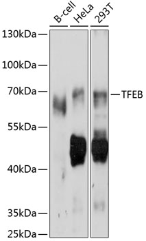 Western blot analysis of extracts of various cell lines using TFEB Polyclonal Antibody at 1:1000 dilution.