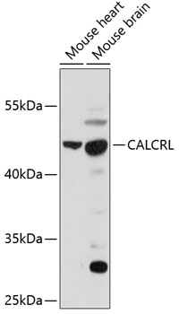 Western blot analysis of extracts of various cell lines using CALCRL Polyclonal Antibody at 1:1000 dilution.