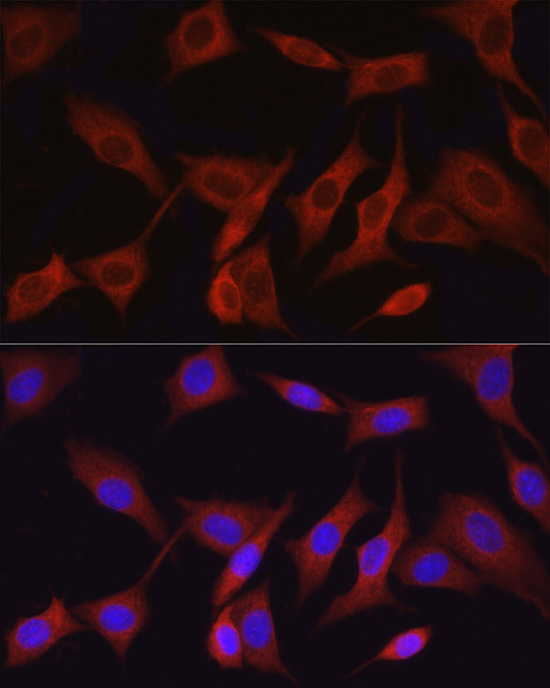 Immunofluorescence analysis of NIH/3T3 cells using TAK1 Polyclonal Antibody at dilution of 1:50 (40x lens). Blue: DAPI for nuclear staining.