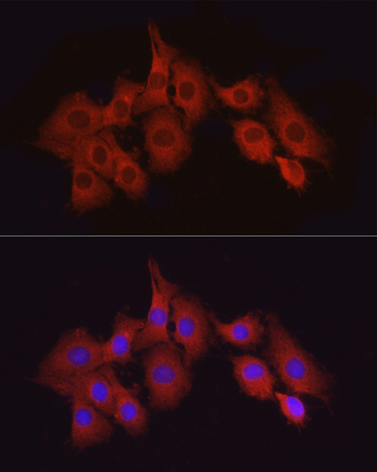 Immunofluorescence analysis of PC-12 cells using TAK1 Polyclonal Antibody at dilution of 1:50 (40x lens). Blue: DAPI for nuclear staining.