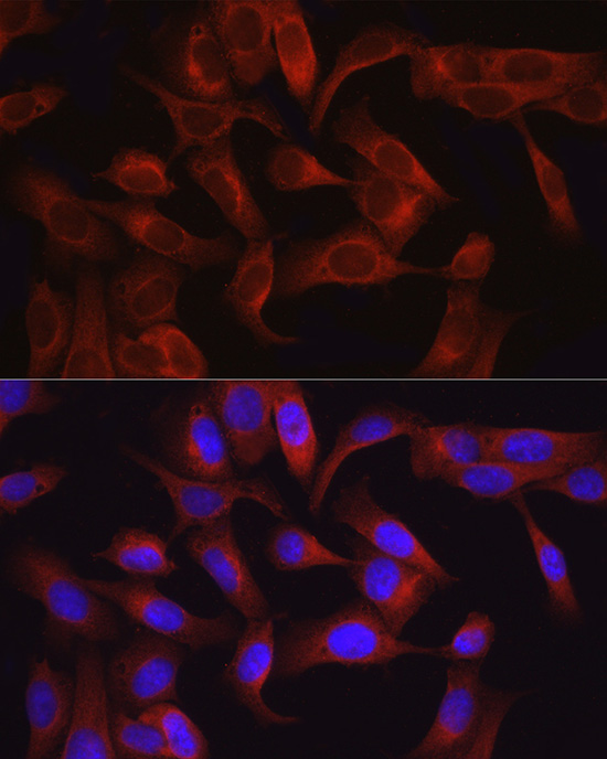 Immunofluorescence analysis of U2OS cells using TAK1 Polyclonal Antibody at dilution of 1:50 (40x lens). Blue: DAPI for nuclear staining.