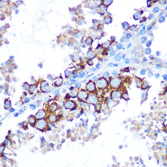 Immunohistochemistry of paraffin-embedded mouse testis using TAK1 Polyclonal Antibody at dilution of 1:100 (40x lens).Perform microwave antigen retrieval with 10 mM Tris/EDTA buffer pH 9.0 before commencing with IHC staining protocol.