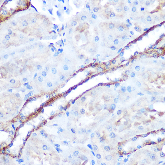 Immunohistochemistry of paraffin-embedded rat kidney using TAK1 Polyclonal Antibody at dilution of 1:100 (40x lens).Perform microwave antigen retrieval with 10 mM Tris/EDTA buffer pH 9.0 before commencing with IHC staining protocol.