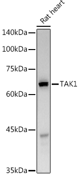 Western blot analysis of extracts of Rat heart using TAK1 Polyclonal Antibody at 1:500 dilution.