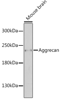 Western blot analysis of extracts of mouse brain using Aggrecan Polyclonal Antibody at 1:1000 dilution.