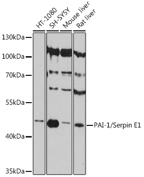 Western blot analysis of extracts of various cell lines using PAI-1/Serpin E1 Polyclonal Antibody at 1:3000 dilution.