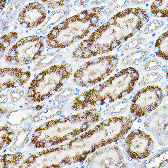 Immunohistochemistry of paraffin-embedded mouse kidney using Alkaline Phosphatase Polyclonal Antibody at dilution of 1:200 (40x lens).Perform high pressure antigen retrieval with 10 mM citrate buffer pH 6.0 before commencing with IHC staining protocol.