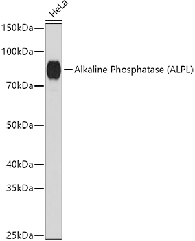 Western blot analysis of extracts of HeLa cells using Alkaline Phosphatase Polyclonal Antibody at 1:1000 dilution.