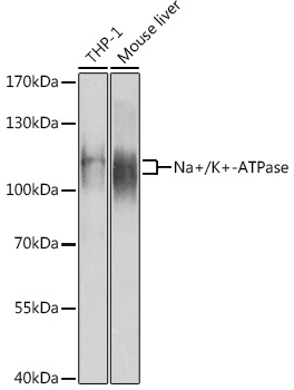 Western blot analysis of extracts of various cell lines using Na+/K+-ATPase1 Polyclonal Antibody at 1:1000 dilution.