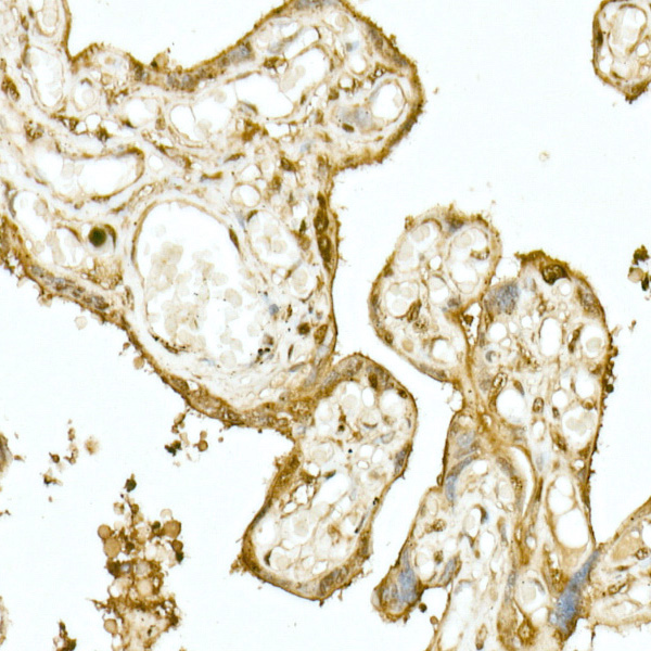 Immunohistochemistry of paraffin-embedded human placenta using NRF2 Polyclonal Antibody at dilution of 1:200 (40x lens).Perform high pressure antigen retrieval with 10 mM citrate buffer pH 6.0 before commencing with IHC staining protocol.