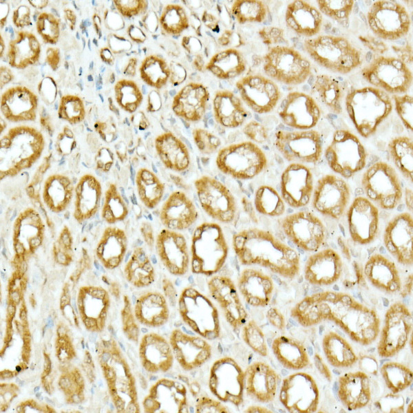 Immunohistochemistry of paraffin-embedded rat kidney using NRF2 Polyclonal Antibody at dilution of 1:200 (40x lens).Perform high pressure antigen retrieval with 10 mM citrate buffer pH 6.0 before commencing with IHC staining protocol.