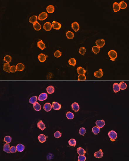 Immunofluorescence analysis of THP-1 cells using EMR1 Polyclonal Antibody at dilution of 1:100 (40x lens). Blue: DAPI for nuclear staining.