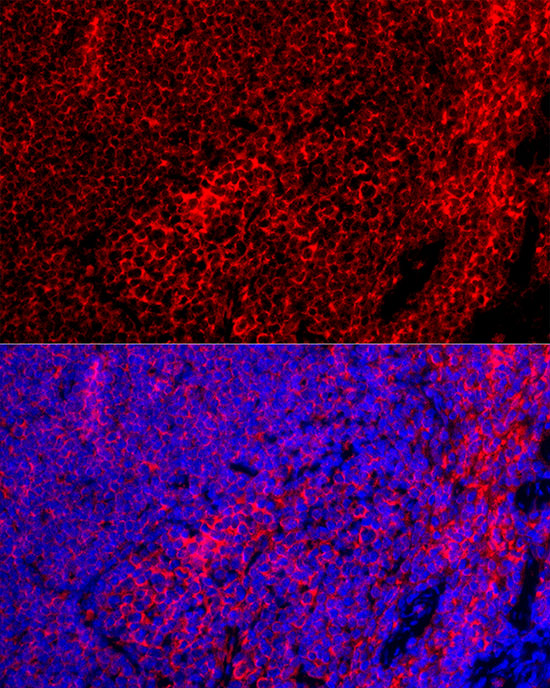 Immunofluorescence analysis of Mouse spleen using EMR1 Polyclonal Antibody at dilution of 1:100 (40x lens). Blue: DAPI for nuclear staining.