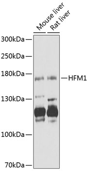 Western blot analysis of extracts of various cell lines using HFM1 Polyclonal Antibody at 1:1000 dilution.