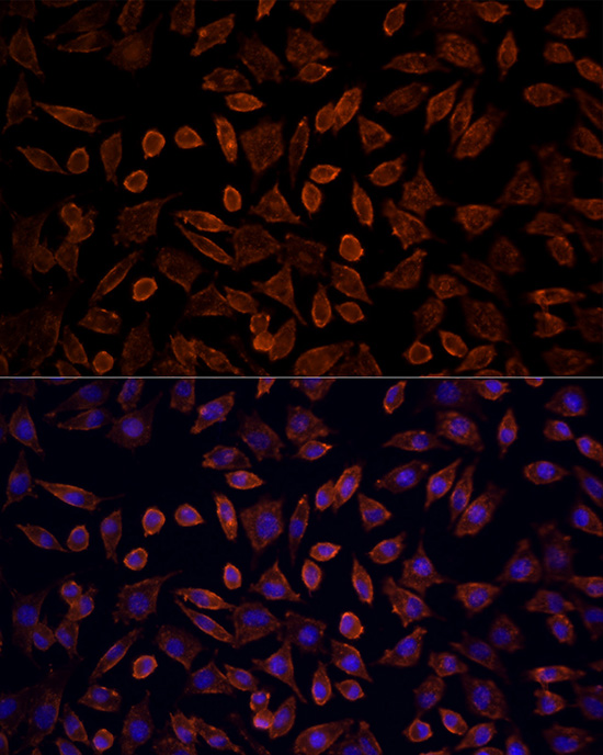 Immunofluorescence analysis of L929 cells using [KO Validated] KRAS Polyclonal Antibody at dilution of 100 (40x lens). Blue: DAPI for nuclear staining.