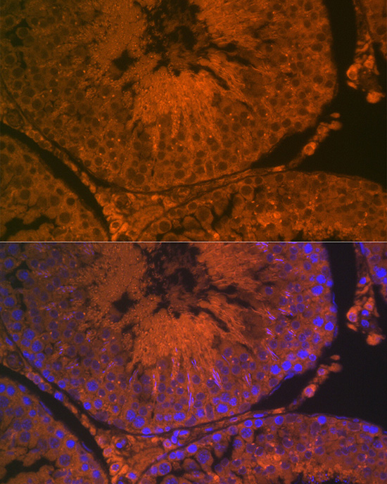 Immunofluorescence analysis of rat testis using ACE2 Polyclonal Antibody at dilution of 1:100 (40x lens). Blue: DAPI for nuclear staining.