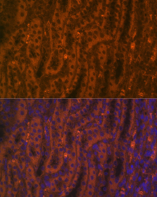 Immunofluorescence analysis of rat kidney using ACE2 Polyclonal Antibody at dilution of 1:100 (40x lens). Blue: DAPI for nuclear staining.