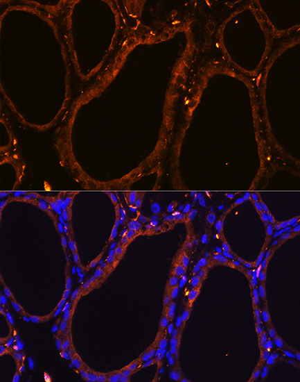 Immunofluorescence analysis of PC-12 cells using WNT5A Polyclonal Antibody at dilution of 1:50 (40x lens). Blue: DAPI for nuclear staining.