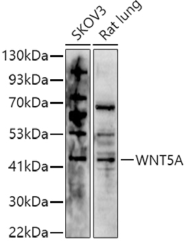 Western blot analysis of extracts of various cell lines using Polyclonal Antibody at 1:1000 dilution.