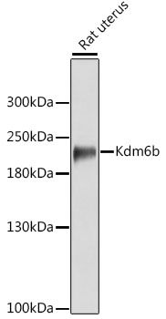 Western blot analysis of extracts of various cell lines using Kdm6b Polyclonal Antibody at 1:3000 dilution.