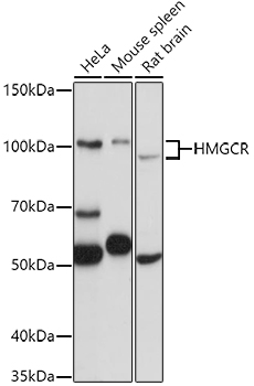 Western blot analysis of extracts of various cell lines using HMGCR Polyclonal Antibody at 1:1000 dilution.