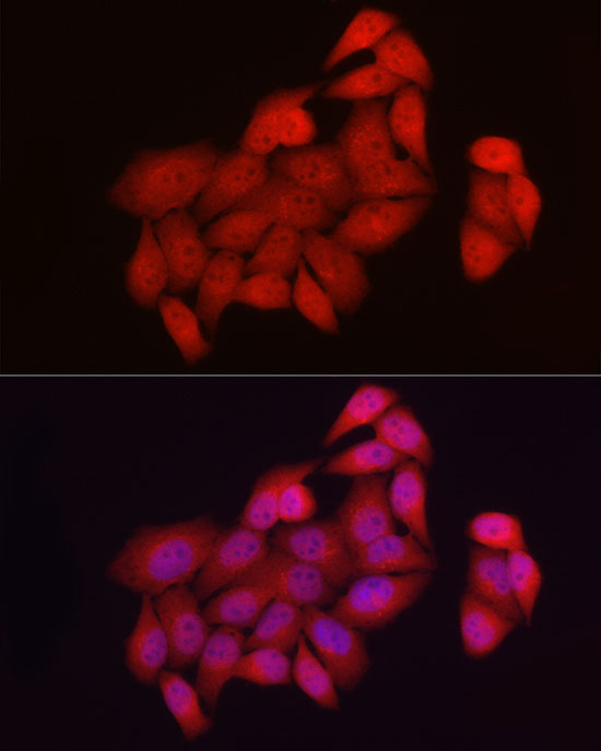 Immunofluorescence analysis of HeLa cells using NUR77 Polyclonal Antibody at dilution of 1:50 (40x lens). Blue: DAPI for nuclear staining.