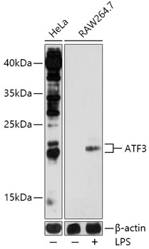 Western blot analysis of extracts of various cell lines using ATF3 Polyclonal Antibody at 1:1000 dilution. Raw264.7 cells were treated by LPS (1 μg/mL) at 37℃ for 8 hours.