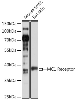 Western blot analysis of extracts of various cell lines using MC1 Receptor Polyclonal Antibody at 1:1000 dilution.