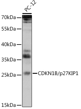 Western blot analysis of extracts of PC-12 cells using CDKN1B/p27KIP1 Polyclonal Antibody at 1:1000 dilution.