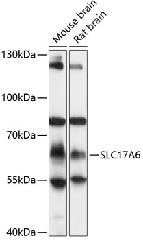 Western blot analysis of extracts of various cell lines using SLC17A6 Polyclonal Antibody at 1:1000 dilution.