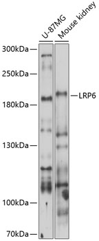 Western blot analysis of extracts of various cell lines using LRP6 Polyclonal Antibody at 1:1000 dilution.