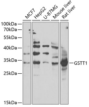 Western blot analysis of extracts of various cell lines using GSTT1 Polyclonal Antibody at 1:1000 dilution.