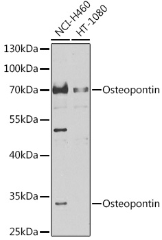 Western blot analysis of extracts of various cell lines using Osteopontin Polyclonal Antibody at 1:1000 dilution.