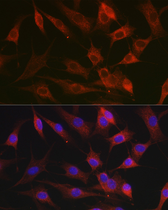 Immunofluorescence analysis of NIH-3T3 cells using CX3CL1 Polyclonal Antibody at dilution of 1:100 (40x lens). Blue: DAPI for nuclear staining.