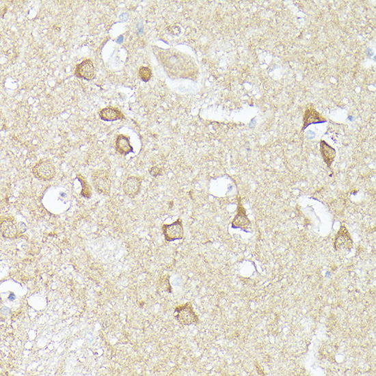 Immunohistochemistry of paraffin-embedded human brain using CX3CL1 Polyclonal Antibody at dilution of 1:100 (40x lens).Perform high pressure antigen retrieval with 10 mM citrate buffer pH 6.0 before commencing with IHC staining protocol.