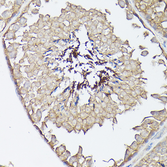 Immunohistochemistry of paraffin-embedded mouse testis using CX3CL1 Polyclonal Antibody at dilution of 1:100 (40x lens).Perform high pressure antigen retrieval with 10 mM citrate buffer pH 6.0 before commencing with IHC staining protocol.