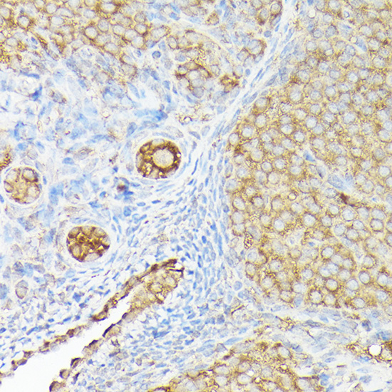 Immunohistochemistry of paraffin-embedded rat ovary using CX3CL1 Polyclonal Antibody at dilution of 1:100 (40x lens).Perform high pressure antigen retrieval with 10 mM citrate buffer pH 6.0 before commencing with IHC staining protocol.