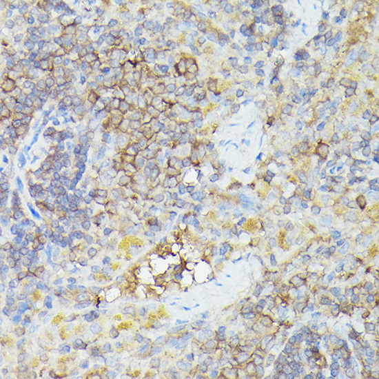 Immunohistochemistry of paraffin-embedded rat spleen using CX3CL1 Polyclonal Antibody at dilution of 1:100 (40x lens).Perform high pressure antigen retrieval with 10 mM citrate buffer pH 6.0 before commencing with IHC staining protocol.