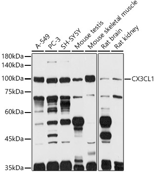 Western blot analysis of extracts of various cell lines using CX3CL1 Polyclonal Antibody at 1:1000 dilution.