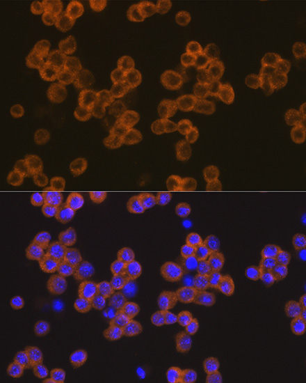 Immunofluorescence analysis of Raw264.7 cells using NLRP3 Polyclonal Antibody at dilution of 1:100 (40x lens). Blue: DAPI for nuclear staining.