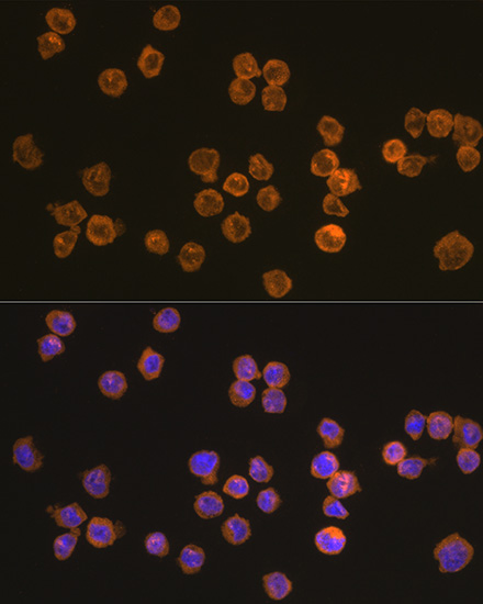 Immunofluorescence analysis of THP-1 cells using NLRP3 Polyclonal Antibody at dilution of 1:100 (40x lens). Blue: DAPI for nuclear staining.