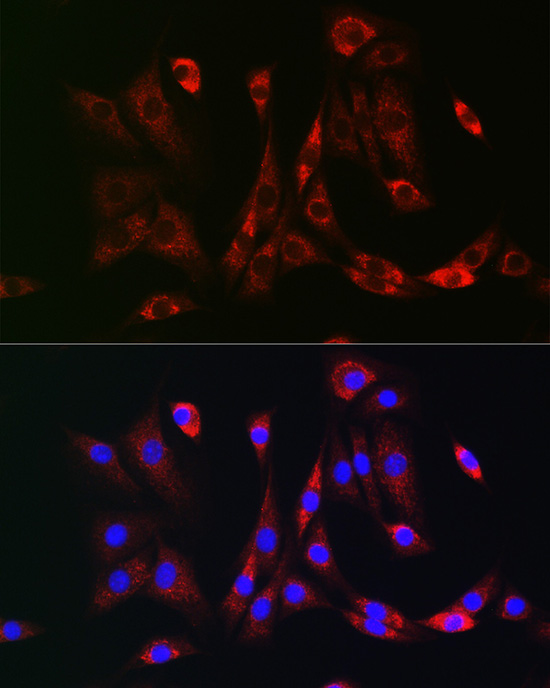 Immunofluorescence analysis of NIH-3T3 cells using PDGFRB Polyclonal Antibody at dilution of 1:100 (40x lens). Blue: DAPI for nuclear staining.