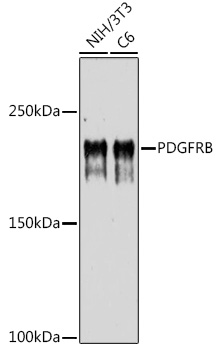 Western blot analysis of extracts of various cell lines using PDGFRB Polyclonal Antibody at 1:1000 dilution.