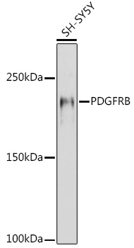 Western blot analysis of extracts of SH-SY5Y cells using PDGFRB Polyclonal Antibody at 1:1000 dilution.