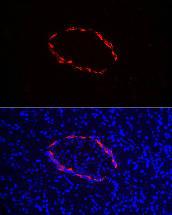 Immunofluorescence analysis of rat pancreas cells using Pro-glucagon Polyclonal Antibody at dilution of 1:100 (40x lens). Blue: DAPI for nuclear staining.