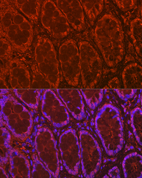 Immunofluorescence analysis of rat rectum using Galectin 3/Galectin 3/LGALS3 Polyclonal Antibody at dilution of 1:100 (40x lens). Blue: DAPI for nuclear staining.