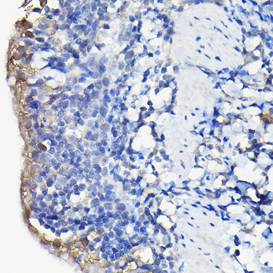 Immunohistochemistry of paraffin-embedded rat lung using Galectin 3/Galectin 3/LGALS3 Polyclonal Antibody at dilution of 1:100 (40x lens).Perform high pressure antigen retrieval with 10 mM citrate buffer pH 6.0 before commencing with IHC staining protocol.