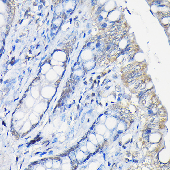 Immunohistochemistry of paraffin-embedded rat colon using Galectin 3/Galectin 3/LGALS3 Polyclonal Antibody at dilution of 1:100 (40x lens).Perform high pressure antigen retrieval with 10 mM citrate buffer pH 6.0 before commencing with IHC staining protocol.